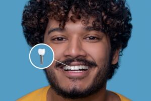 Learn about the dental implant process in Metairie, LA
